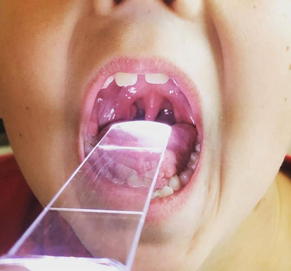 Throat Scope Closeup Inside the Mouth