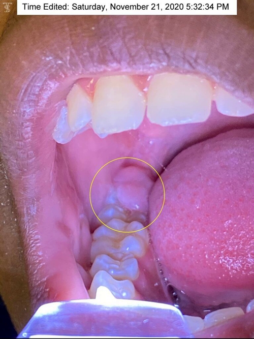 dental growing pains